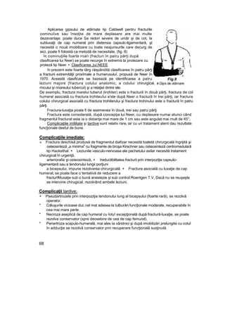 Aplicarea gipsului de atârnate tip Caldwell pentru fracturile
cominuîive sau însoţite de mare deplasare are mai multe
dezavantaje: poate duce Sa redori severe de umăr şi de cot, la
subluxaţii de cap numeral prin distensia capsulc-ligamentară, şt
necesită o nouă imobilizare cu toate neajunsurile care decurg de
aici, poate fi folosită ca metodă de necesitate, (fig. 8)
în cominuţiile foarte rnari (fracturi în patru părţi după
clasificarea lui Neer) se poate recurge în extremis la protezare cu
proteză tip Neer. • Clasificarea.,|ui,NEEE
în prezent este foarte târg răspândită clasificarea în patru părţi
a fracturii extremităţii proxîmale a hurnerusuluî, propusă de Neer în
1970. Această clasificare se bazează pe identificarea a patru
leziuni majore (fractura colului anatomic, a colului chirurgical, a
micului şi nnareului tubercul) şi a relaţiei dintre ele.
De exemplu, fractura marelui tuberul (trohiter) este o fractură în două părţi, fractura de col
humeral asociată cu fractura trohiteuîui e'ste după Neer o fractură în trei părţi, iar fractura
colului chirurgical asociată cu fractura trohiterului şi fractura trohinului este o fractură în patru
părţi.
Fraciura-luxaţia poate fi de asemenea în două, trei sau patru părţi.
Fractura este considerată, după concepţia lui Neer, cu deplasare numai atunci când
fragmentul fracturat este ia o distanţa mai mare de 1 cm sau este angulat mai rnult de 45°,
Complicaţiile imMiate şi tardive sunt relativ raret iar cu un tratament atent dau rezultate
funcţionale destul de bune.
Complicaţiile imediate:
» Fractura deschisă produsă de fragmentul diafizar necesită toaletă chirurgicală îngrijită şi
osteosinteză „a minima" cu fragmente de broşa Kirschner sau osteosinteză centromedulară
tip Hackethal. + Leziunile vasculo-nervoase ale pachetului axilar necesită tratament
chirurgical în urgenţă,
arteriorafie şi osteosinteză, + Ireductibilitatea fracturii prin interpoziţie capsulo-
Iigamentară sau a tendonului lungii porţiuni
a bicepsului, impune rezolvarea chirurgicală. + Fractura asociată cu luxaţie de cap
humeral; se poate face o tentativă de reducere a
fracturîMuxaţie sub o bună anestezie şi sub control Roentgen T.V, Dacă nu se reuşeşte
se intervine chirugical, rezolvând ambele leziuni,
Complicaţii tardive:
+ Pseudartrozele prin interpoziţia tendonului lung al bicepsului (foarte rară), se rezolvă
operator.
* Căluşurile vicioase duc cel mat adesea la tulburări funcţionale moderate, recuperabile în
cea mai mare parte.
* Necroza aseptică de cap humeral cu îotu! excepţională după fractură-luxaţie, se poate
rezolva conservator (spre deosebire de cea de cap femural).
* Periartroza scapulo-humeralâ, mai ales Ia vârstnici şi după imobilizări prelungite cu cotul
în adducţie se rezolvă conservator prin recuperare funcţională susţinută.
68
Fig.8
Gips de stârnare
 