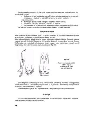 Deplasarea fragmentelor în fracturile supracondilîene se poate realiza în unul din
următoarele moduri:
» deplasarea în jurul unui ax transversal, în sens anterior sau posterior (prezentată
mai sus); » deplasarea laterală în jurul unui ax antero-posterior, în
valgus sau varus;
* translaţia - deplasarea tn întregime a epîfizei în sens lateral;
* decalajul - răsucirea epifizei în juruî unui ax vertical;
* ascensiunea, cu încălecare, care deplasează paleta înaintea sau înapoia diafizei
De cele mai multe ori aceste tipuri de deplasare coexistă în grade variabile.
Simptomatologie
» La inspecţie: plică cotului este „plină", cu echimoză liniară tip Kirmisson, olecranui deplasai
şi proeminent, distanţa acromioepicondiiiană este scurtată.
# La palpare bolnavul acuză dureri la nivelul liniei epicondiloepitrohleene. Reperelş osoase
clasice normale (linia lui Malgaigne şi triunghiul Nelaton), împreună cu semnul Cooper
(deformaţia uşor reductibilă prin tracţiune şi care reapare când tracţiunea a încetat) permit
diagnosticul diferenţial cu luxaţia posterioară de cot (ftg. 13).
Fig. 13
Repere normale aţe cotului:
cubitus valgus,
triunghiul NEALTON,
linia MALGAIGNE
Este obligatorie verificarea pulsului la artera radiată, a mobilităţii degetelor şi înregistrarea
eventualei cianoze, a furnicăturilor şi hipoesîeziei, şi, în general, a diferitelor tipuri de parestezii
în teritoriul nervilor membrului superior.
Examenul radiologie de faţă şi profil este ceî care pune diagnosticul de certitudine.
Evoluţie
Fractura consolidează dacă este bine redusă si imobilizată; datorită complicaţiilor frecvente
însă, prognosticul funcţional este rezervat.
74
 