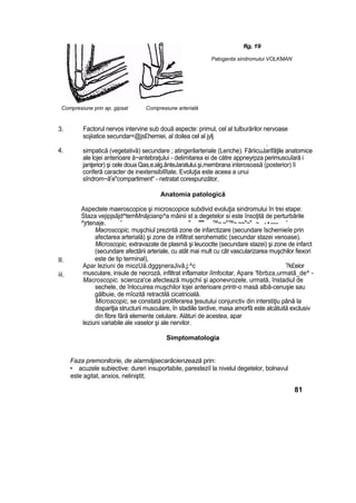 fig, 19
Patogenta sindromului VOLKMAN
Compresiune prin ap. gipsat Compresiune arterială
3.
4.
II.
iii.
Factorul nervos intervine sub două aspecte: primul, cel al tulburărilor nervoase
sojiiatice secundar<@js£hemiei, al doilea cel al jylj
.
simpatică (vegetativă) secundare ; atingerilarteriale (Leriche). FâriicuJarifăţile anatomice
ale lojei anterioare ă~antebraţului - delimitarea ei de către appneyrpza perimuscuîară i
janţerior) şi cele doua Qas,e.alg.ânteJaratului.şi,membrana interosoasă (posterior) îi
conferă caracter de inextensibilîtate. Evoluţia este aceea a unui
sîndrom~âr
e"compartimentu
- netratat corespunzător,
Anatomia patologică
Aspectele maeroscopice şi microscopice subdivid evoluţia sindromului în trei etape:
Staza vejipjsăjd^temMnăjcianp^a mâinii st a degetelor si este însoţită de perturbările
^jrtenaje. ' " """ ™~ ~"™~ ~~"~" ~ - • -— '
Macroscopic, muşchiul prezintă zone de infarctizare (secundare îschemieîe prin
afectarea arterială) şi zone de infiltrat serohematic (secundar stazei venoase).
Microscopic, extravazate de plasmă şi leucoctte (secundare stazei) şi zone de infarct
(secundare afectării arteriale, cu atât mai mult cu cât vascularizarea muşchilor fiexori
este de tip terminal),
Apar leziuni de miozUă.dggşneraJivâ,j:^c ?k£eior
musculare, insule de necroză, infiltrat inflamator iîmfocitar, Apare 'fibrbza,urmatâ_de^ -
Macroscopic. scieroza'ce afectează muşchii şi aponevrozele, urmată, înstadiul de
sechele, de înlocuirea muşchilor lojei anterioare printr-o masă albâ-cenuşie sau
gălbuie, de mîozită retractilă cicatricială.
Microscopic, se constată proliferarea ţesutului conjunctiv din interstiţiu până la
dispariţia structurii musculare, în stadiile tardive, masa amorfă este alcătuită exclusiv
din fibre fără elemente celulare. Alături de acestea, apar
leziuni variabile ale vaselor şi ale nervilor.
Simptomatologia
Faza premonitorie, de alarmăjsecarâcienzează prin:
• acuzele subiective: dureri insuportabile, paresteziî la nivelul degetelor, bolnavul
este agitat, anxios, neliniştit;
81
 