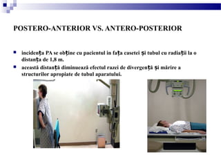 POSTERO-ANTERIOR VS. ANTERO-POSTERIOR
 inciden a PA se ob ine cu pacientul in fa a casetei i tubul cu radia ii la oț ț ț ș ț
distan a de 1,8 m.ț
 această distan ă diminuează efectul razei de divergen ă i mărire aț ț ș
structurilor apropiate de tubul aparatului.
 