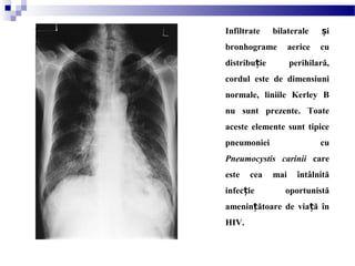Infiltrate bilaterale iș
bronhograme aerice cu
distribu ie perihilară,ț
cordul este de dimensiuni
normale, liniile Kerley B
nu sunt prezente. Toate
aceste elemente sunt tipice
pneumoniei cu
Pneumocystis carinii care
este cea mai întâlnită
infec ie oportunistăț
amenin ătoare de via ă înț ț
HIV.
 