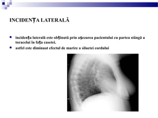 INCIDEN A LATERALĂȚ
 inciden a laterală este ob inută prin a ezarea pacientului cu partea stângă aț ț ș
toracelui în fa a casetei.ț
 astfel este diminuat efectul de marire a siluetei cordului
 