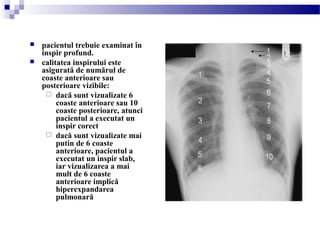  pacientul trebuie examinat în
inspir profund.
 calitatea inspirului este
asigurată de numărul de
coaste anterioare sau
posterioare vizibile:
 dacă sunt vizualizate 6
coaste anterioare sau 10
coaste posterioare, atunci
pacientul a executat un
inspir corect
 dacă sunt vizualizate mai
putin de 6 coaste
anterioare, pacientul a
executat un inspir slab,
iar vizualizarea a mai
mult de 6 coaste
anterioare implică
hiperexpandarea
pulmonară
 