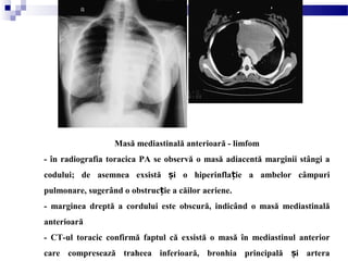 Masă mediastinală anterioară - limfom
- în radiografia toracica PA se observă o masă adiacentă marginii stângi a
codului; de asemnea exsistă i o hiperinfla ie a ambelor câmpuriș ț
pulmonare, sugerând o obstruc ie a căilor aeriene.ț
- marginea dreptă a cordului este obscură, indicând o masă mediastinală
anterioară
- CT-ul toracic confirmă faptul că exsistă o masă în mediastinul anterior
care compresează traheea inferioară, bronhia principală i arteraș
 