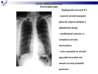 MASE MEDIASTINALE
POSTERIOARE
Radiografie toracică PA
- masă la nivelul marginii
pleurale supero-mediale a
plămânului drept;
- mediastinul anterior se
termină la nivelul
claviculelor;
- orice anomalie la nivelul
apexului toracelui este
situată cel mai probabil
posterior.
 