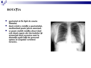 ROTA IAȚ
 pacientul să fie lipit de caseta
filmului.
 dacă există o rota ie a pacientului,ț
mediastinul poate părea anormal.
 se poate stabili rota ia observândț
cele două capete ale claviculelor iș
urmarind dacă aceastea sunt la
distan ă egală fa ă de procesulț ț
spinos al corpului vertebrei
toracice.
 