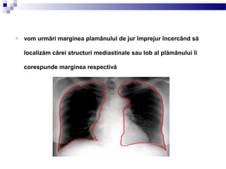 o vom urmări marginea plamânului de jur împrejur încercând să
localizăm cărei structuri mediastinale sau lob al plămânului îi
corespunde marginea respectivă
 