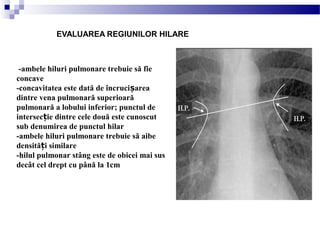 EVALUAREA REGIUNILOR HILARE
-ambele hiluri pulmonare trebuie să fie
concave
-concavitatea este dată de încruci areaș
dintre vena pulmonară superioară
pulmonară a lobului inferior; punctul de
intersec ie dintre cele două este cunoscutț
sub denumirea de punctul hilar
-ambele hiluri pulmonare trebuie să aibe
densită i similareț
-hilul pulmonar stâng este de obicei mai sus
decât cel drept cu până la 1cm
 