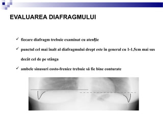  fiecare diafragm trebuie examinat cu aten ieț
 punctul cel mai înalt al diafragmului drept este în general cu 1-1,5cm mai sus
decât cel de pe stânga
 ambele sinusuri costo-frenice trebuie să fie bine conturate
EVALUAREA DIAFRAGMULUI
 