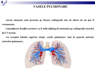 VASELE PULMONARE
oaceste elemente sunt prezente pe fiecare radiografie dar de obicei ele nu pot fi
recunoscute.
ocunoa terea loca iei acestora va fi utilă în elegerii anatomiei pe radiografia toracicăș ț ț
i CT toracic.ș
ocu exceptia lobului superior drept, venele pulmonare sunt în general anterior
arterelor pulmonare.
 