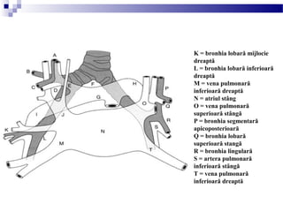 K = bronhia lobară mijlocie
dreaptă
L = bronhia lobară inferioară
dreaptă
M = vena pulmonară
inferioară dreaptă
N = atriul stâng
O = vena pulmonară
superioară stângă
P = bronhia segmentară
apicoposterioară
Q = bronhia lobară
superioară stangă
R = bronhia lingulară
S = artera pulmonară
inferioară stângă
T = vena pulmonară
inferioară dreaptă
 
