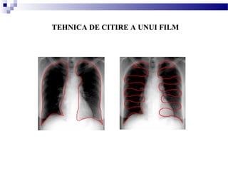 TEHNICA DE CITIRE A UNUI FILM
 