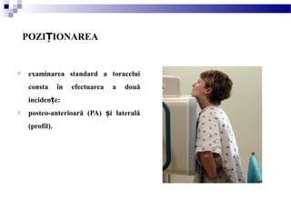 POZI IONAREAȚ
o examinarea standard a toracelui
consta în efectuarea a două
inciden e:ț
o posteo-anterioară (PA) i lateralăș
(profil).
 