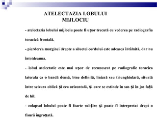 ATELECTAZIA LOBULUI
MIJLOCIU
- atelectazia lobului mijlociu poate fi u or trecută cu vederea pe radiografiaș
toracică frontală.
- pierderea marginei drepte a siluetei cordului este adeasea întâlnită, dar nu
întotdeauna.
- lobul atelectatic este mai u or de recunoscut pe radiografie toracicaș
laterala ca o bandă densă, bine definită, liniară sau triunghiulară, situată
între scizura oblică i cea orizontală, i care se extinde în sus i în jos fa ăș ș ș ț
de hil.
- colapsul lobului poate fi foarte sub ire i poate fi interpretat drept oț ș
fisură îngro ată.ș
 