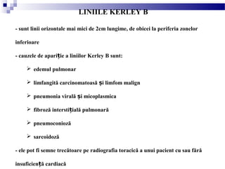 LINIILE KERLEY B
- sunt linii orizontale mai mici de 2cm lungime, de obicei la periferia zonelor
inferioare
- cauzele de apari ie a liniilor Kerley B sunt:ț
 edemul pulmonar
 limfangită carcinomatoasă i limfom malignș
 pneumonia virală i micoplasmicaș
 fibroză intersti ială pulmonarăț
 pneumoconioză
 sarcoidoză
- ele pot fi semne trecătoare pe radiografia toracică a unui pacient cu sau fără
insuficien ă cardiacăț
 