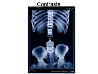 Contraste 