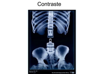 Contraste
 
