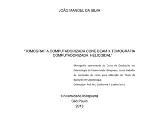 JOÃO MANOEL DA SILVA




“TOMOGRAFIA COMPUTADORIZADA CONE BEAM X TOMOGRAFIA
             COMPUTADORIZADA HELICOIDAL”

                       Monografia apresentada ao Curso de Graduação em
                       Odontologia da Universidade Ibirapuera, como trabalho
                       de conclusão de curso para obtenção do Título de
                       Bacharel em Odontologia.
                       Orientador: Prof. MS. Guilherme T. Coelho Terra



                Universidade Ibirapuera
                      São Paulo
                         2013
 
