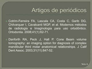    Cotrim-Ferreira FA, Lascala CA, Costa C, Garib DG,
    Chilvarquer I, Cavalcanti MGP, et al. Modernos métodos
    de radiologia e Imaginologia para uso ortodôntico.
    Ortodontia. 2008;41(1):62-71.

   Danforth RA, Peck J, Hall P. Cone Beam volume
    tomography: an imaging option for diagnosis of complex
    mandibular third molar anatomical relationships. J Calif
    Dent Assoc. 2003;31(11):847-52.



                                                        Terra, G.
 