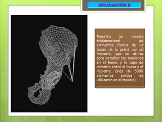 APLICACIÓN 8




Muestra       un      modelo
tridimensional           de
elementos finitos de un
hueso de la pelvis con un
implante, que se utiliza
para estudiar las tensiones
en el hueso y la capa de
cemento entre el hueso y el
implante. (más de 5000
elementos      solidos    se
utilizaron en el modelo)
 