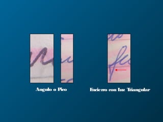 Angulo o Pico Encierro con Luz Triangular
 