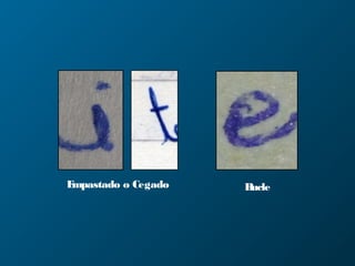 Empastado o Cegado Bucle
 