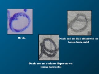 Ovalo Ovalo con un lazo dispuesto en
forma horizontal
Ovalo con un encierro dispuesto en
forma horizontal
 