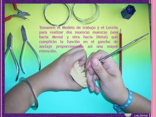 Tomamos el Modelo de trabajo y el Lecròn para realizar dos muescas muescas (una hacia Mesial y otra hacia Distal) que cumplirán la función en el gancho de anclaje proporcionando así una mayor retención.Lab.Dental