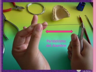 Paralelismo del AlambreLab.Dental