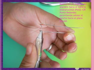 Realizamos el doblaje del alambre hacia el Espacio Interproximal (Pinza 139 Punta Redonda) permitiendo adosar el gancho hacia el plano oclusalLab.Dental