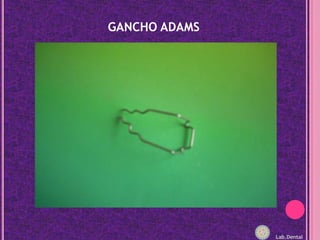 GANCHO ADAMSLab.Dental