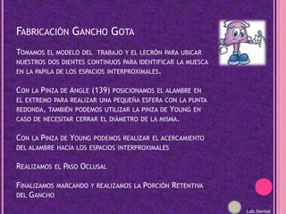 Fabricación Gancho GotaTomamos el modelo del  trabajo y el lecròn para ubicar nuestros dos dientes continuos para identificar la muesca  en la papila de los espacios interproximales.Con la Pinza de Angle (139) posicionamos el alambre en el extremo para realizar una pequeña esfera con la punta redonda, también podemos utilizar la pinza de Young en caso de necesitar cerrar el diámetro de la misma.Con la Pinza de Young podemos realizar el acercamiento del alambre hacia los espacios interproximalesRealizamos el Paso OclusalFinalizamos marcando y realizamos la Porción Retentiva del GanchoLab.Dental