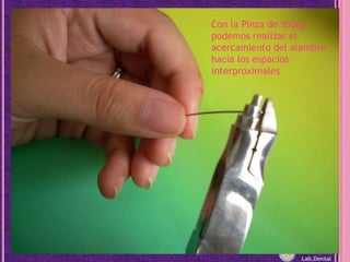 Con la Pinza de Young podemos realizar el acercamiento del alambre hacia los espacios interproximalesLab.Dental