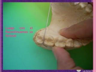 Luego con el Pacontinuamos so OclusalLab.Dental
