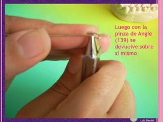 Luego con la pinza de Angle (139) se devuelve sobre si mismoLab.Dental