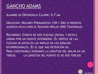 GANCHO ADAMSAlambre de Ortodoncia Calibre: 0.7 mm Ubicación: Molares Permanentes (1M y 2M) si presenta ausencia aplica para el Segundo Molar (2M) TemporalesRecorrido: Consta de dos flechas (mesial y distal) unidas por un puente intermedio. El vértice de las flechas se apoya en las papilas de los espacios interproximales. Es el que más retención da.Para construirlo dividimos la longitud del molar en un tercio,       la longitud del puente es de dos terciosLab.Dental