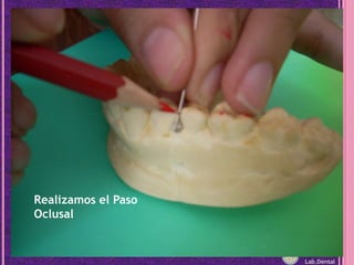 Realizamos el Paso Oclusal<br />Lab.Dental<br />