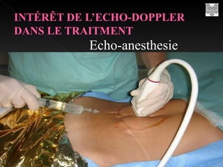 Echo-anesthesie 