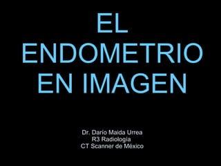 EL ENDOMETRIO EN IMAGEN Dr. Darío Maida Urrea R3 Radiología  CT Scanner de México 