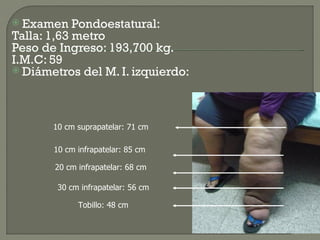  Examen    Pondoestatural:
Talla: 1,63 metro
Peso de Ingreso: 193,700 kg.
I.M.C: 59
 Diámetros del M. I. izquierdo:




       10 cm suprapatelar: 71 cm

       10 cm infrapatelar: 85 cm

       20 cm infrapatelar: 68 cm

        30 cm infrapatelar: 56 cm

             Tobillo: 48 cm
 