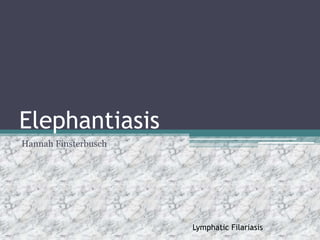 Elephantiasis
Hannah Finsterbusch
Lymphatic Filariasis
 