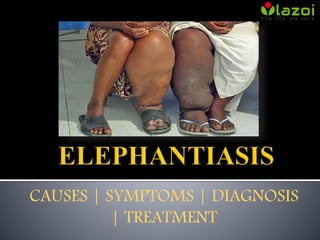 CAUSES | SYMPTOMS | DIAGNOSIS
| TREATMENT
 