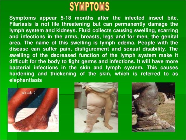 Elephantiasis presentation1