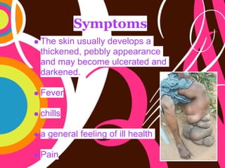 *+,$'-,)
    "#$!18/)!414+**3!2$9$*-61!+!
    &#/58$)$2:!6$00*3!+66$+'+)5$!
    +)2!(+3!0$5-($!4*5$'+&$2!+)2!
    2+'8$)$2;
!
    <$9$'
!
    5#/**1
!
    +!,$)$'+*!.$$*/),!-.!/**!#$+*&#!
!
    =+/)
 