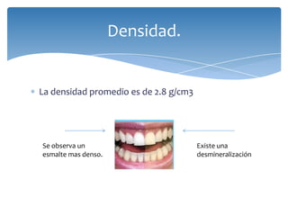 Densidad.


La densidad promedio es de 2.8 g/cm3




Se observa un                          Existe una
esmalte mas denso.                     desmineralización
 