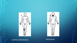 CERVICALGIACICATRIZ HIPERSENSÍVEL
 