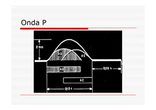 Onda P
 