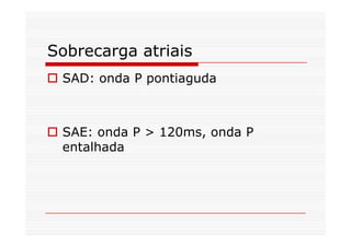 Sobrecarga atriais
SAD: onda P pontiaguda
SAE: onda P > 120ms, onda P
entalhada
 