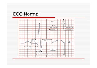 ECG Normal
 