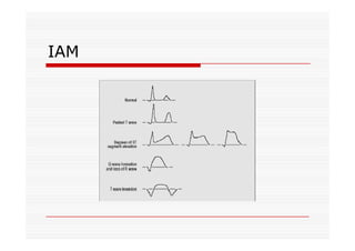 IAM
 